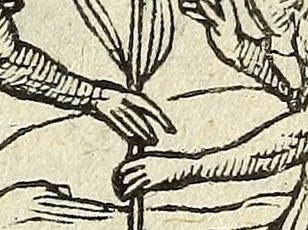 The Hand in Facundia difficilis
